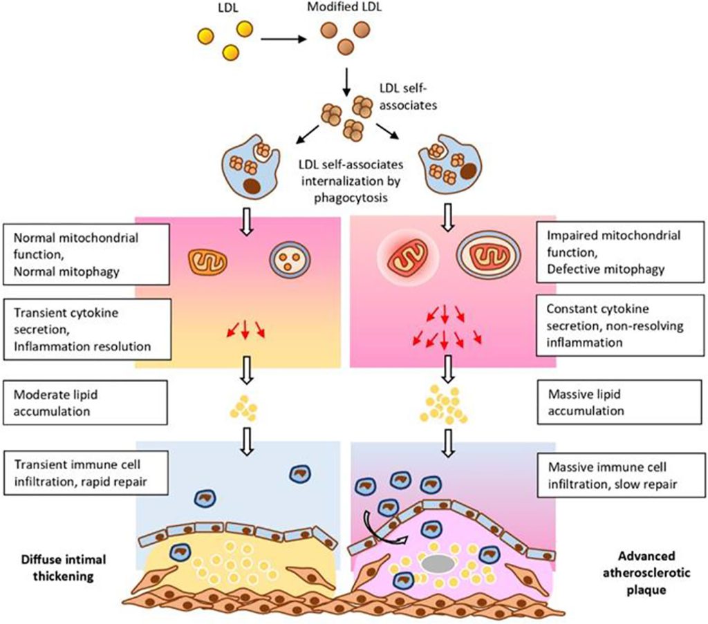 Mechanism Of Atherosclerosis Lecture Notes