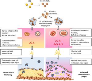 Mechanism of Atherosclerosis